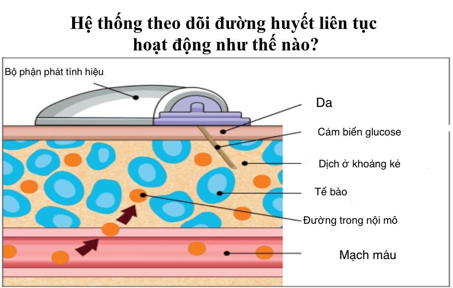 CGM là gì: Hệ thống Theo dõi Glucose Liên tục và Vai trò của nó CGM là gì: Hệ thống Theo dõi Glucose Liên tục và Vai trò của nó