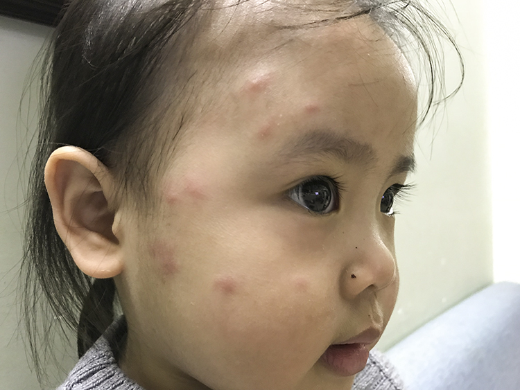 Phun thuốc muỗi có hại cho trẻ sơ sinh không: Giải pháp bảo vệ an toàn Phun thuốc muỗi có hại cho trẻ sơ sinh không: Giải pháp bảo vệ an toàn