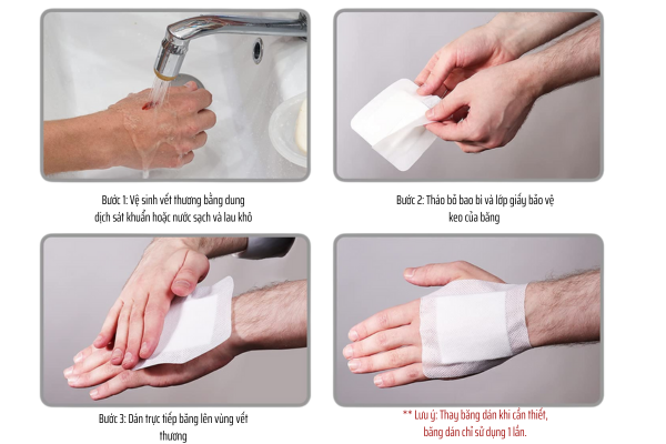 Gạc Vô Khuẩn: Vai Trò Quan Trọng và Hướng Dẫn Sử Dụng Chuẩn Y Tế Gạc Vô Khuẩn: Vai Trò Quan Trọng và Hướng Dẫn Sử Dụng Chuẩn Y Tế