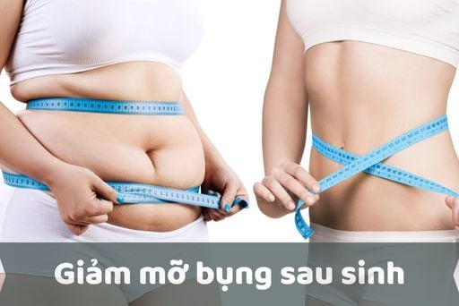 Cách làm giảm mỡ bụng sau sinh bằng gừng hiệu quả, an toàn
