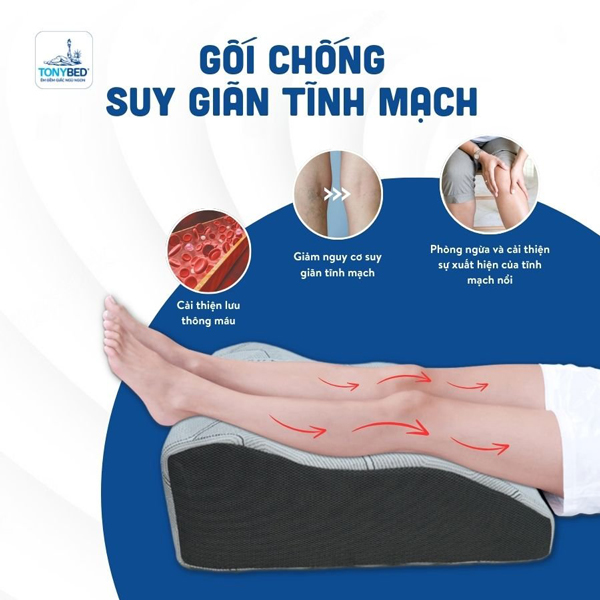 Gối Giãn Tĩnh Mạch: Giải Pháp Hiệu Quả Cho Đôi Chân Khỏe Mạnh