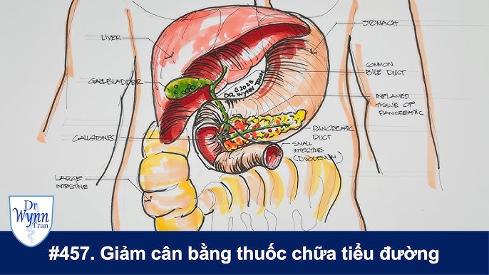 Uống thuốc tiểu đường có ảnh hưởng dạ dày không? Giải đáp chi tiết