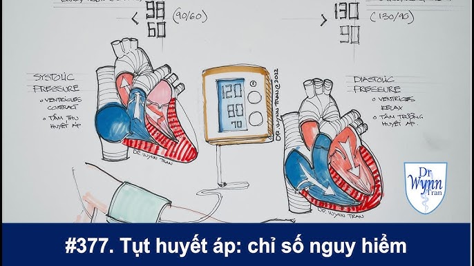 Hiểu Rõ Chỉ Số Huyết Áp 60 90: Nguyên Nhân Và Giải Pháp Hiệu Quả