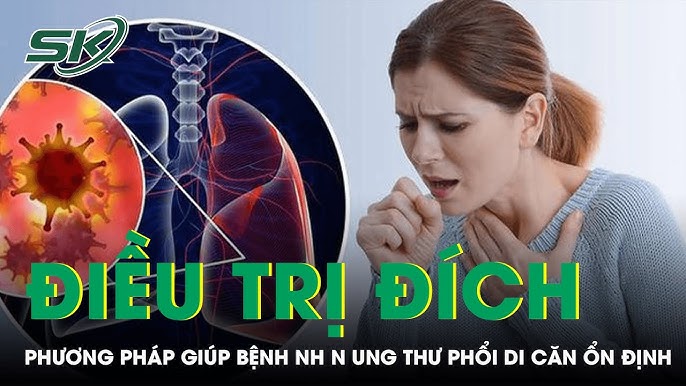 Cách Điều Trị Ung Thư Di Căn Xương Bằng Cây Thuốc Hiệu Quả Cách Điều Trị Ung Thư Di Căn Xương Bằng Cây Thuốc Hiệu Quả