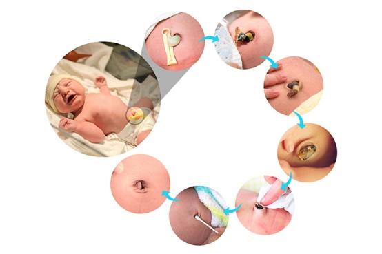 Chăm Sóc Rốn Bé Vừa Rụng: Giải Đáp Thoa Thuốc Sát Khuẩn & Lưu Ý
