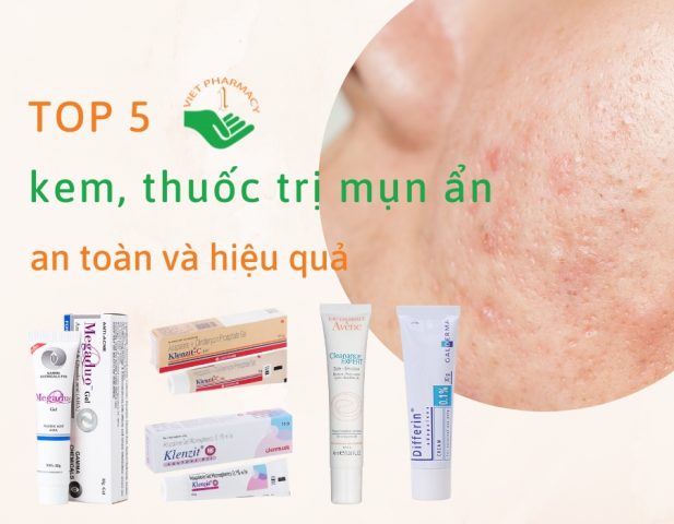 Những Loại Thuốc Trị Mụn Cho Da Dầu Hiệu Quả: Hướng Dẫn Chi Tiết