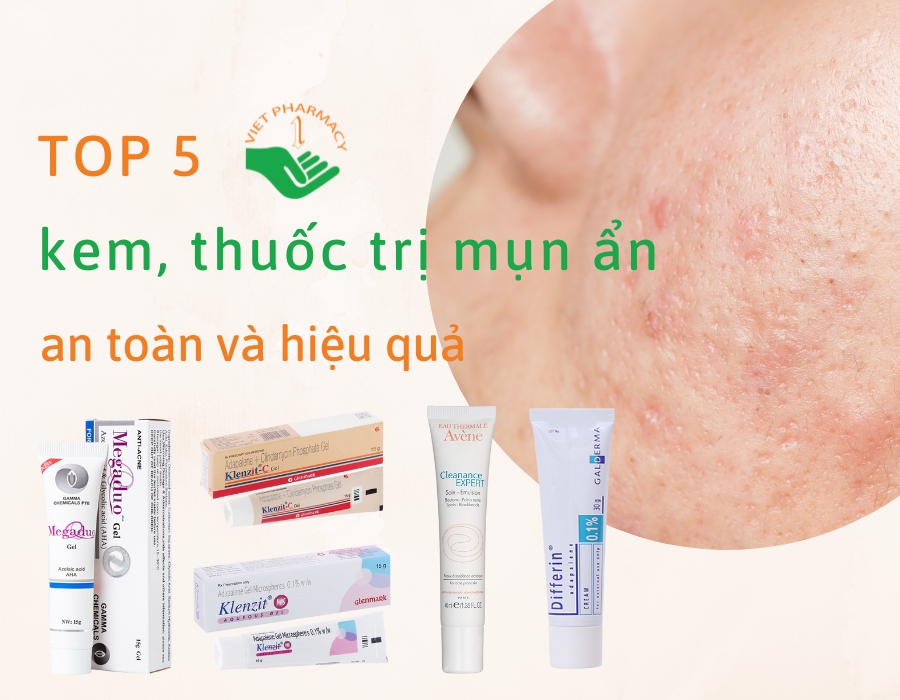 Thuốc Trị Mụn Dành Cho Phụ Nữ Cho Con Bú: Lựa Chọn An Toàn Thuốc Trị Mụn Dành Cho Phụ Nữ Cho Con Bú: Lựa Chọn An Toàn