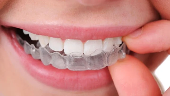 Cách Trị Nghiến Răng Khi Ngủ Hiệu Quả Dứt Điểm Cách Trị Nghiến Răng Khi Ngủ Hiệu Quả Dứt Điểm
