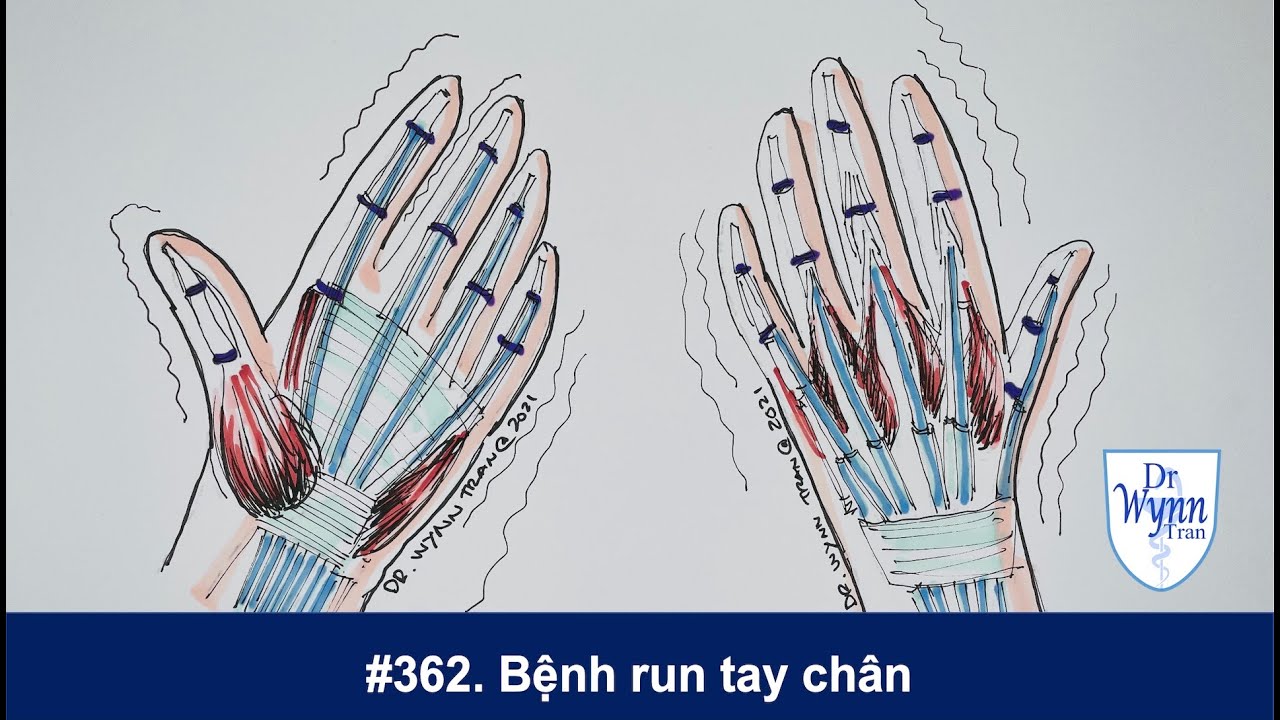 Tại Sao Bị Run Tay Chân Sau Khi Uống Thuốc? Nguyên Nhân Và Giải Pháp