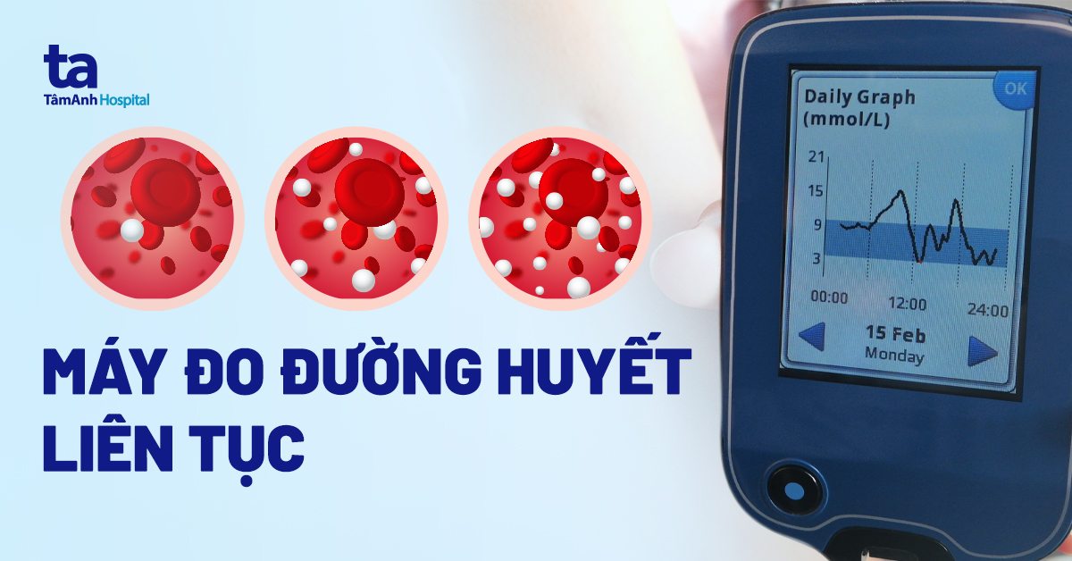 Máy Đo Đường Huyết Liên Tục: Giải Pháp Quản Lý Tiểu Đường Hiện Đại