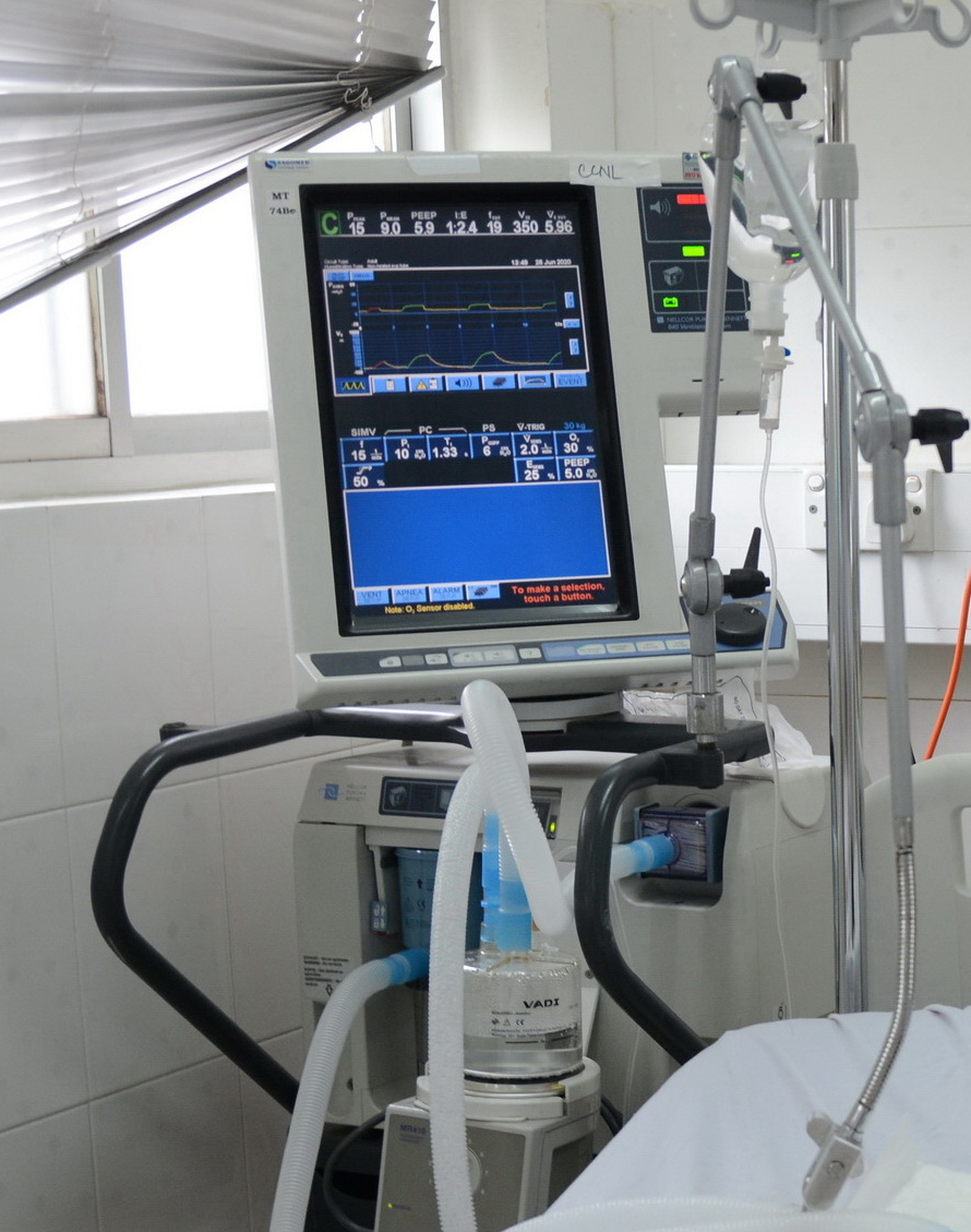 Máy Thở Giá Bao Nhiêu? Phân Tích Chi Tiết Giá và Yếu Tố Ảnh Hưởng