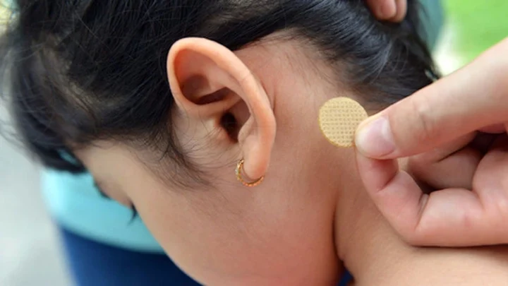 Miếng Dán Chống Say Xe: Giải Pháp Hiệu Quả Cho Mọi Hành Trình