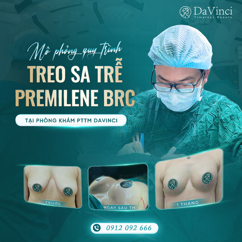 Premilene Mesh: Ứng Dụng Và Ưu Nhược Điểm Trong Y Khoa
