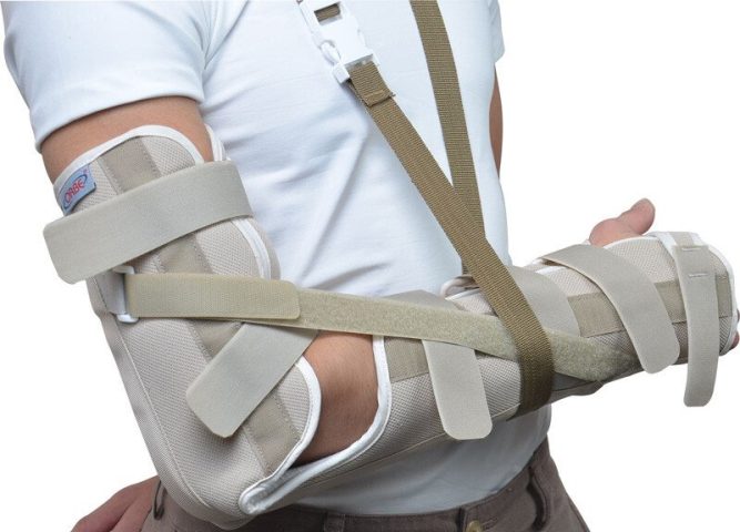 Nẹp Tay: Hướng Dẫn Chi Tiết Về Công Dụng Và Cách Sử Dụng Hiệu Quả