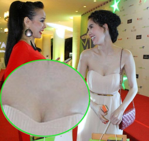 Ngực Nổi Gân Xanh: Nguyên Nhân, Dấu Hiệu Và Cách Xử Lý Hiệu Quả