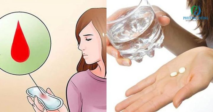 Hướng Dẫn Ngừng Uống Thuốc Tránh Thai Đúng Cách và An Toàn