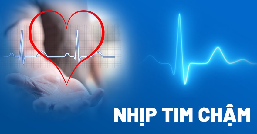 Thuốc và Cách Ăn Uống Cho Người Chậm Nhịp Tim Hiệu Quả Thuốc và Cách Ăn Uống Cho Người Chậm Nhịp Tim Hiệu Quả