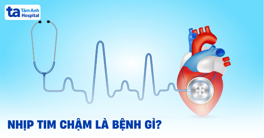Thuốc và Cách Ăn Uống Cho Người Chậm Nhịp Tim Hiệu Quả Thuốc và Cách Ăn Uống Cho Người Chậm Nhịp Tim Hiệu Quả