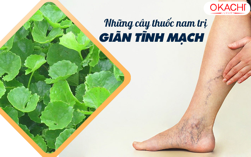 Cây thuốc nam chữa suy giãn tĩnh mạch: Giải pháp tự nhiên hiệu quả