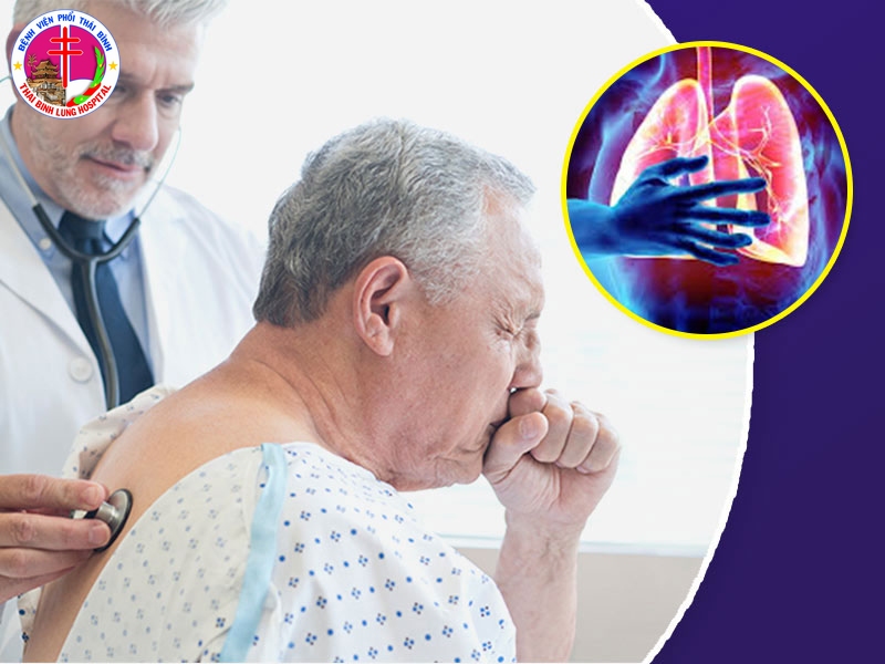 Nguyên nhân bệnh nhân lao không uống thuốc đúng liều và cách khắc phục