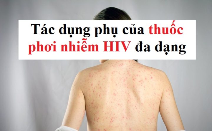 Tác Hại Của Thuốc Chống Phơi Nhiễm HIV: Toàn Diện & Chuyên Sâu