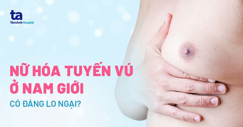 Uống Thuốc Tamoxifen Điều Trị Nữ Hóa Tuyến Vú Nam: Hướng Dẫn Chi Tiết
