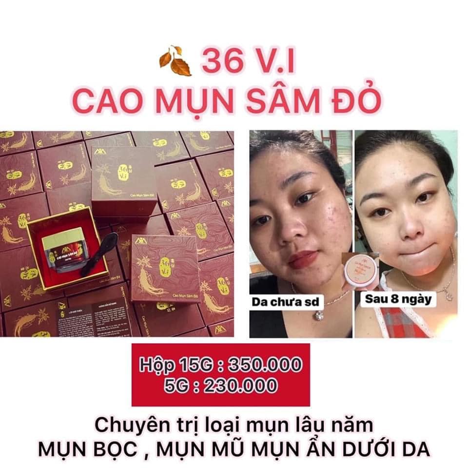 Ai Đã Trị Mụn Bằng Cao Thuốc Bắc Linh Nghiêm: Phân Tích Thực Hư Hiệu Quả