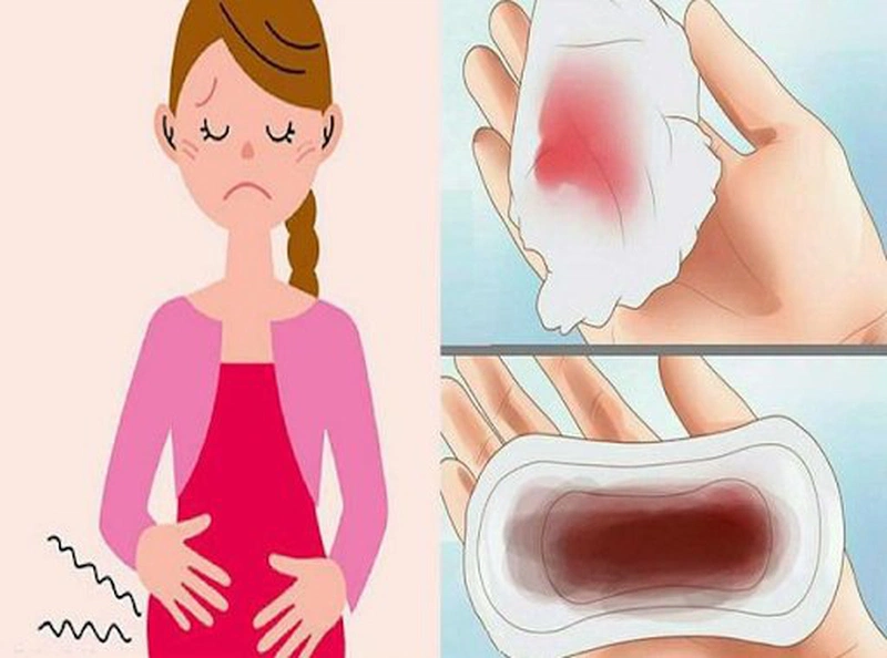 Rối Loạn Kinh Nguyệt Sau Khi Uống Thuốc Phá Thai: Nguyên Nhân & Cách Xử Lý