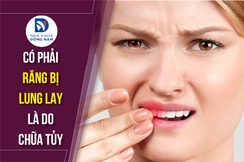 Răng Bị Lung Lay Sau Khi Đặt Thuốc Diệt Tủy: Nguyên Nhân và Cách Xử Lý