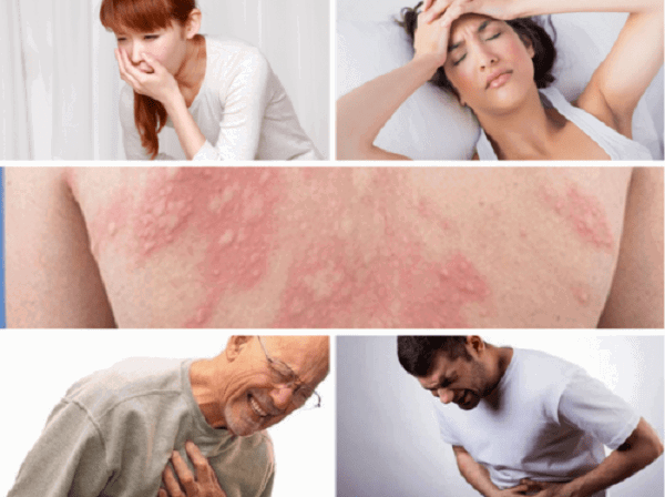 Tác Dụng Phụ Thuốc Kháng Sinh Dạ Dày: Toàn Diện Từ A Đến Z Tác Dụng Phụ Thuốc Kháng Sinh Dạ Dày: Toàn Diện Từ A Đến Z