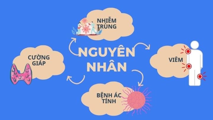 Người lớn sốt không rõ nguyên nhân được chăm sóc y tế