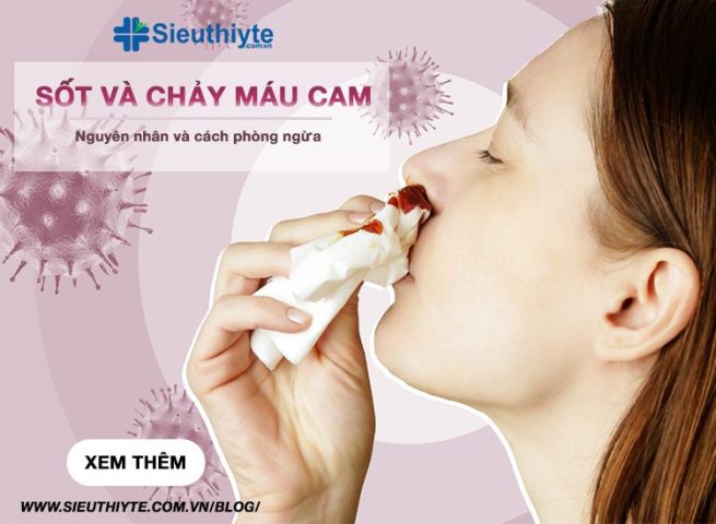 Sốt Chảy Máu Mũi: Hiểu Rõ Nguyên Nhân và Xử Lý Đúng Cách