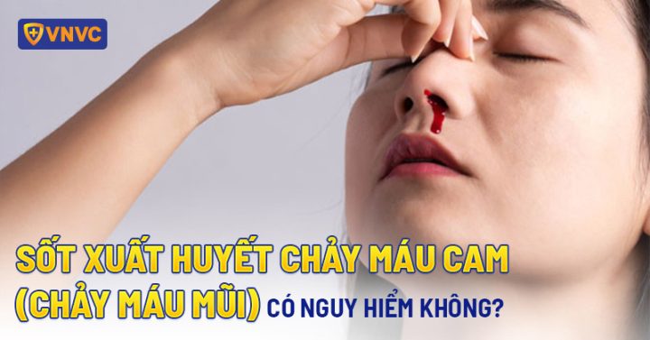 Sốt Chảy Máu Mũi: Hiểu Rõ Nguyên Nhân và Xử Lý Đúng Cách