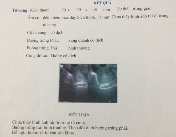 Thai Chưa Vào Tử Cung: Nguyên Nhân, Dấu Hiệu Và Cách Xử Lý Hiệu Quả Thai Chưa Vào Tử Cung: Nguyên Nhân, Dấu Hiệu Và Cách Xử Lý Hiệu Quả