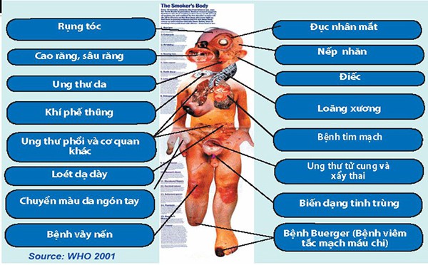 Tác Hại Của Thuốc Lá Đối Với Dây Thần Kinh: Mối Đe Dọa Nghiêm Trọng