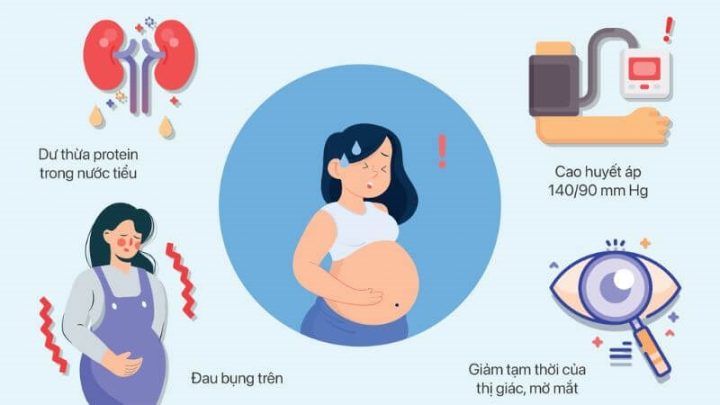 Quản Lý Tăng Huyết Áp Thai Kỳ Hiệu Quả và An Toàn