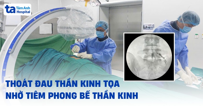 Tiêm Thuốc Giảm Đau Thần Kinh Tọa: Khi Nào Nên Và Không Nên Áp Dụng
