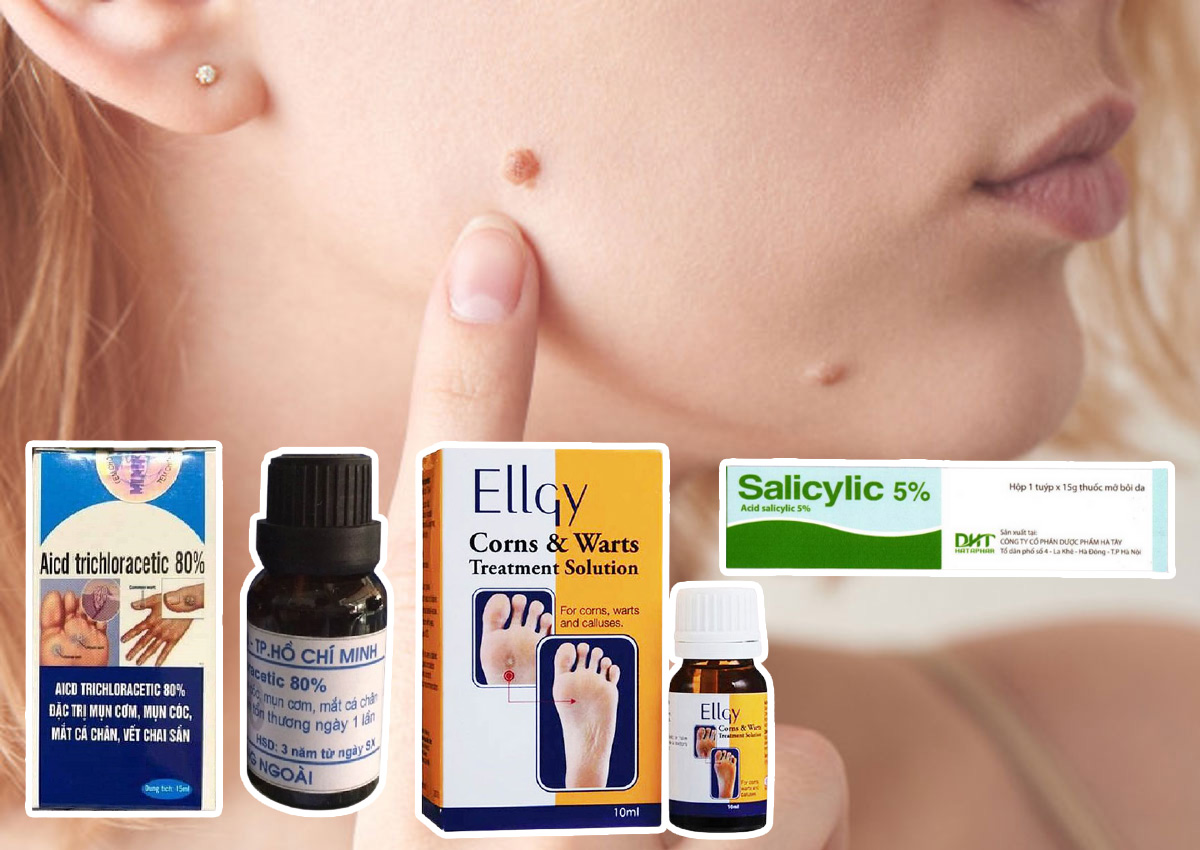Top Địa Chỉ Nơi Bán Thuốc Ellgy Trị Mụn Cóc Ở Hải Phòng Uy Tín