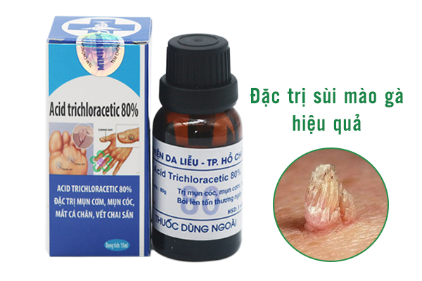 Giải mã liệu trình từ site thuocnambac.com trị sùi mào gà bằng thuốc nam