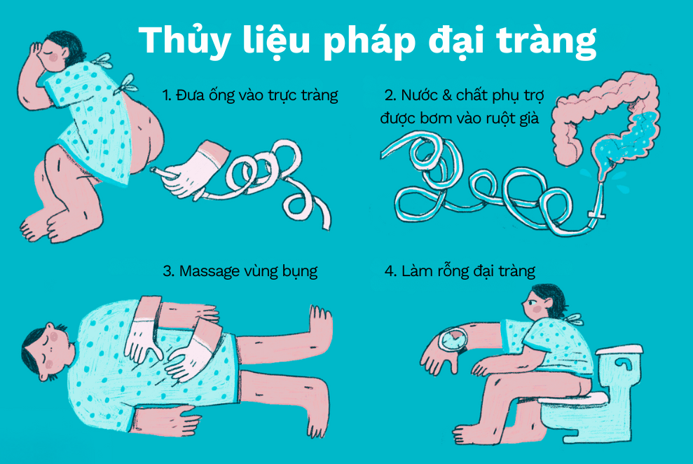 Bộ Thải Độc Đại Tràng: Hướng Dẫn Toàn Diện Từ A-Z