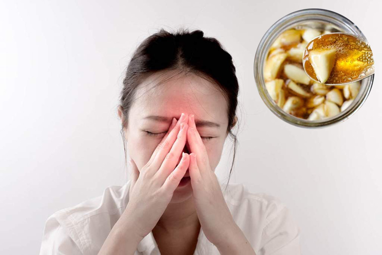 Tỏi Mật Ong Chữa Viêm Xoang: Hiệu Quả và Cách Dùng Đúng Cách