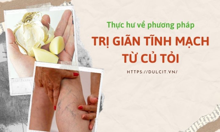 Tỏi Trị Giãn Tĩnh Mạch: Sự Thật Khoa Học & Cách Dùng An Toàn Tỏi Trị Giãn Tĩnh Mạch: Sự Thật Khoa Học & Cách Dùng An Toàn