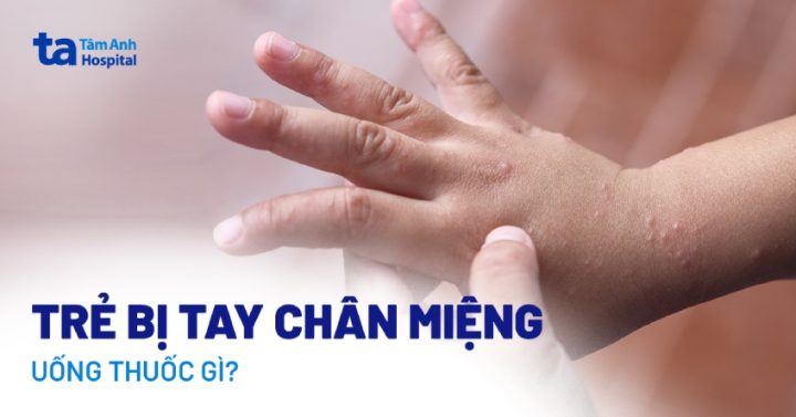 Thuốc Điều Trị Bệnh Chân Tay Miệng Ở Trẻ Em: Hướng Dẫn Chi Tiết