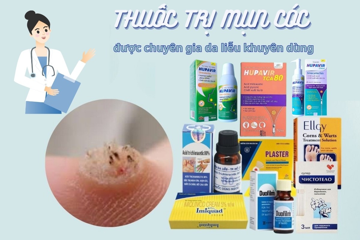 Thuốc Bôi Trị Mụn Cóc Chiết Xuất Từ Tự Nhiên: Giải Pháp An Toàn và Hiệu Quả
