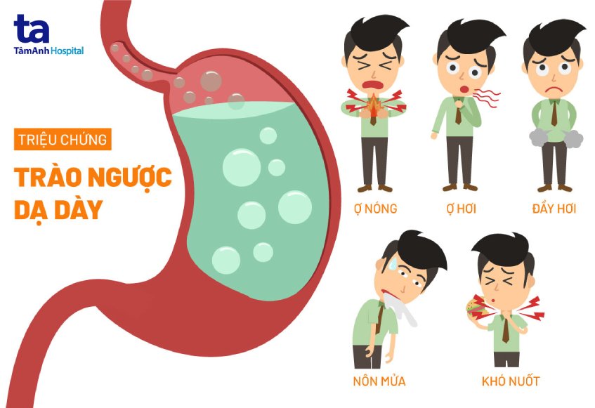 Bệnh Trào Ngược Bao Tử Buồn Nôn Uống Thuốc Gì? Giải Pháp Điều Trị Hiệu Quả