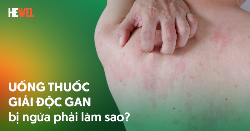 Uốn Thuốc Xổ Độc Gan: Bao Lâu Mới Có Thai An Toàn?