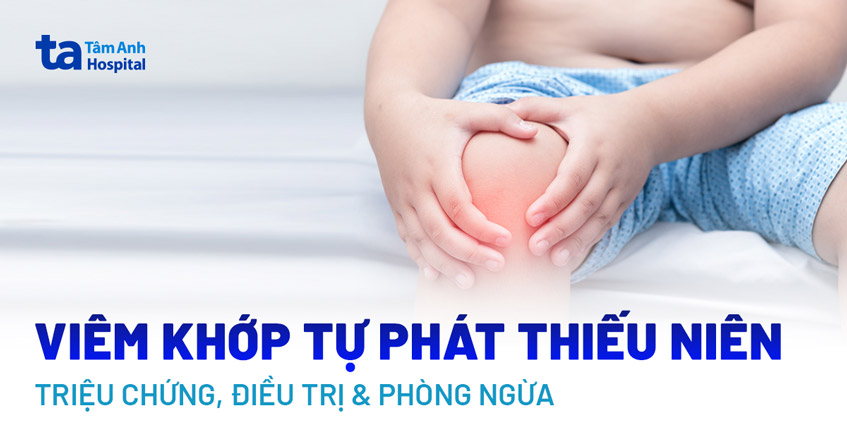 Đơn thuốc điều trị thấp khớp cấp ở trẻ em: Hướng dẫn chuyên sâu