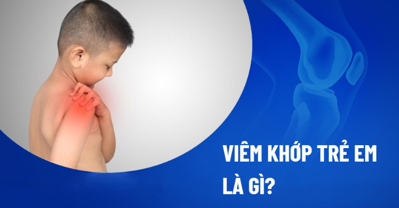 Đơn thuốc điều trị thấp khớp cấp ở trẻ em: Hướng dẫn chuyên sâu