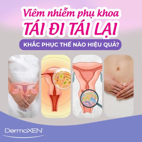 Viêm Phụ Khoa Đã Đặt Thuốc Nhưng Lại Tái Phát: Nguyên Nhân và Giải Pháp Toàn Diện